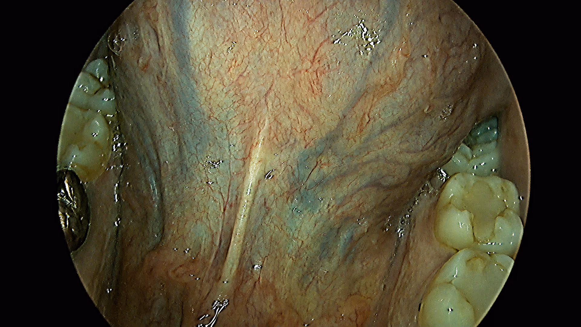 Conventional white-light view of oral tissue vasculature